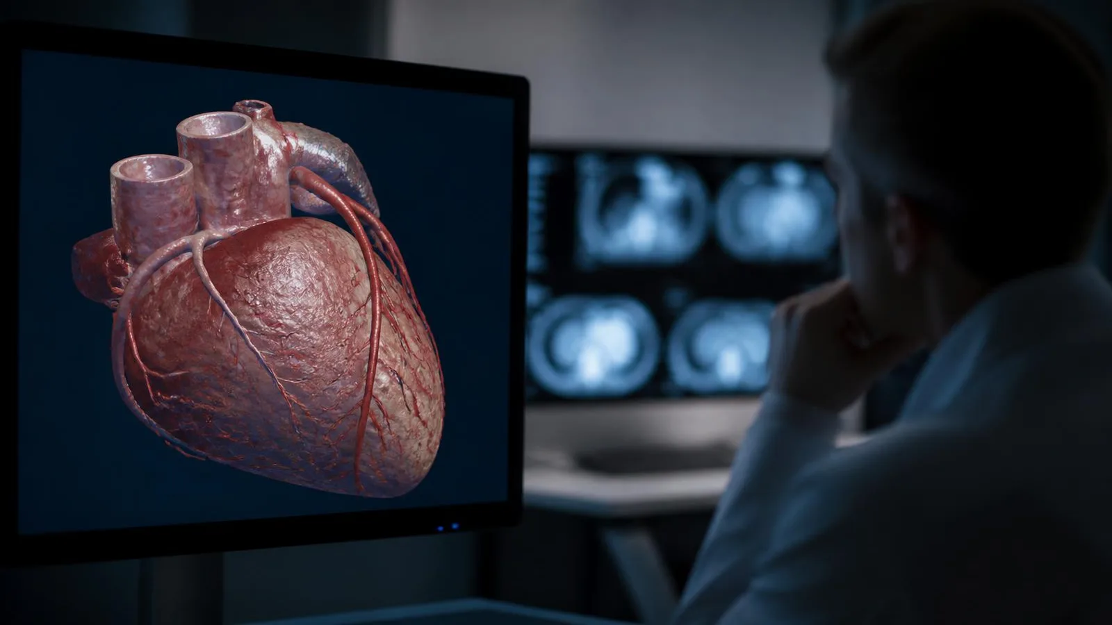 Läkarens skärm visar 3D-rekonstruktion av kranskärlen vid datortomografi av hjärtat